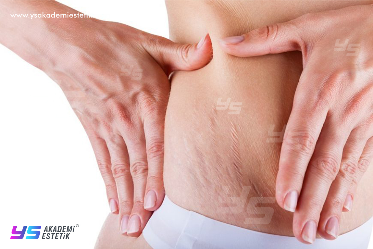 pendik Striort Striort